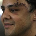 Foto e video intervista a Massa dopo l'incidente