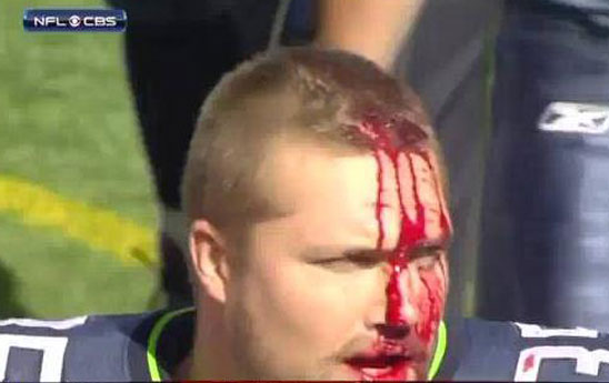 USA: giocatore di football si spacca la testa con il casco